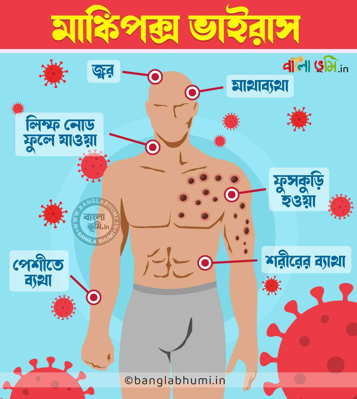 Symptoms of monkeypox in bengali - মাঙ্কি পক্সের লক্ষণ