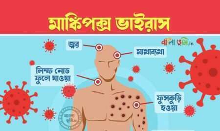 মাঙ্কিপক্স কি? কারণ, লক্ষণ ও চিকিৎসা | Monkeypox Virus in Bengali